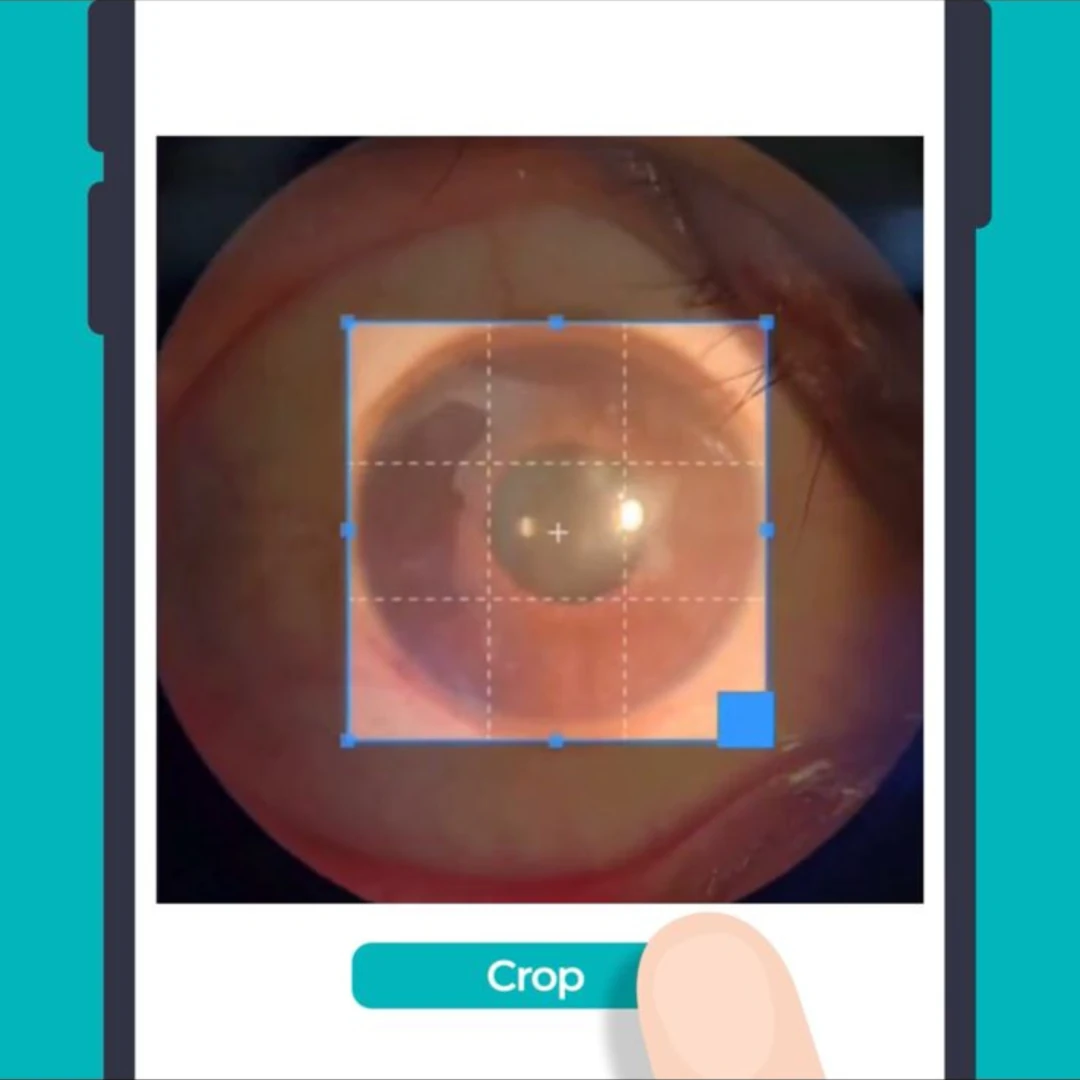 Drag the box to crop, making sure the position of the eye image matches the example. Once it matches, press "Crop" then "Analyze".