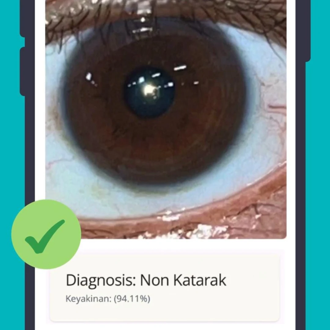 Results will appear: Cataract, Non Cataract, or an error occurred.